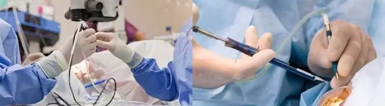 Operácia na obnovenie zraku